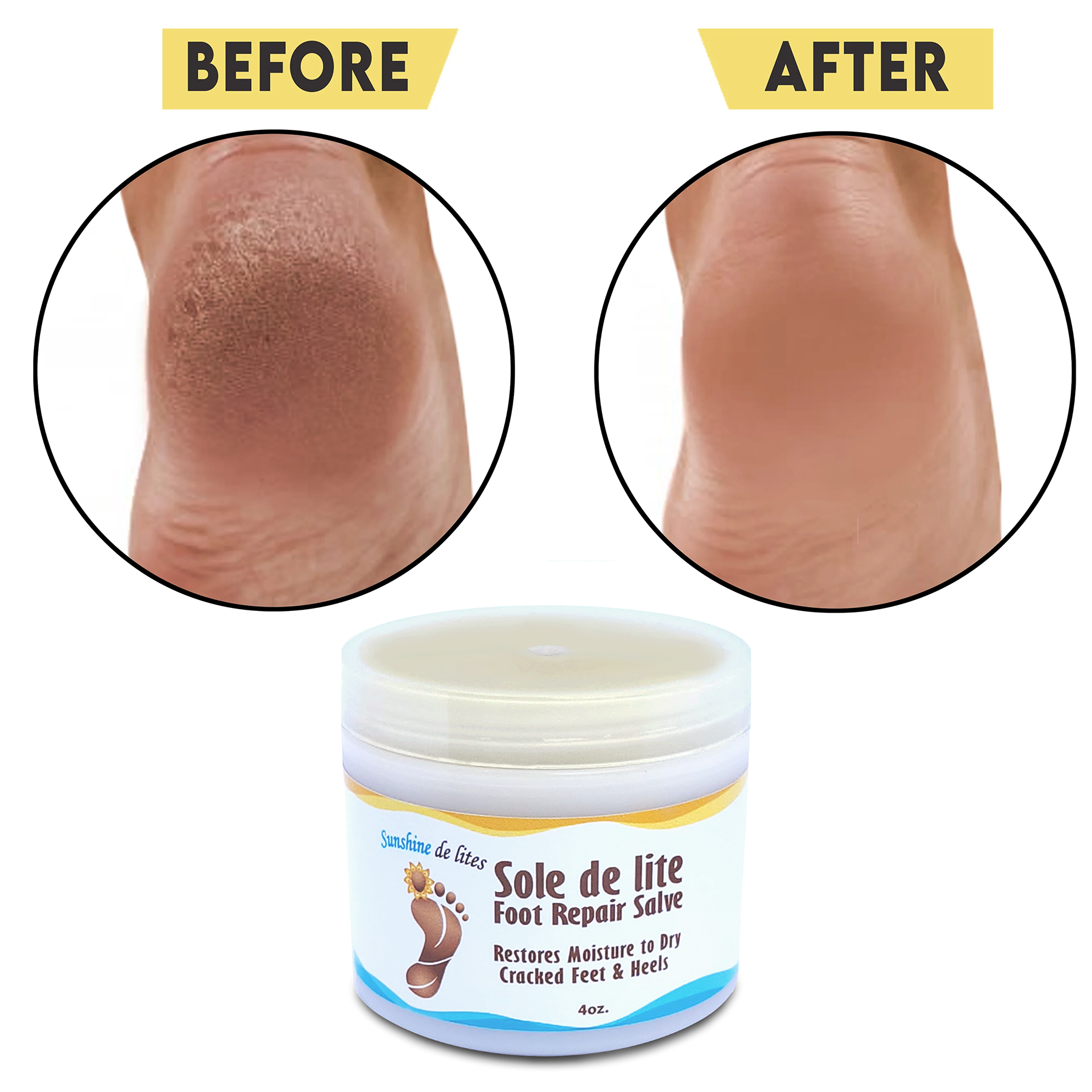 dry cracked rough feet before and smooth soft after feet cream treatment