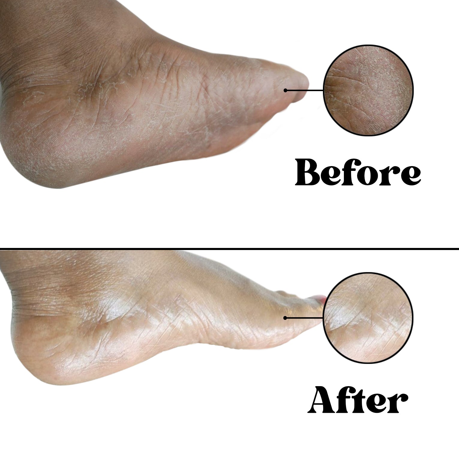 foot repair pretty feet before and after